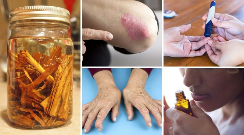 Cinnamon Oil: 5 Surprising Benefits and Uses (DIY recipe)