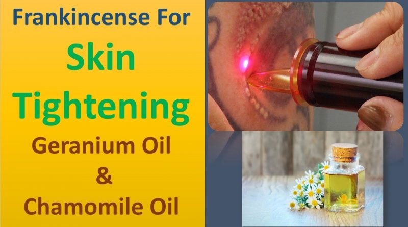 Frankincense for skin tightening | Geranium Oil & Chamomile Oil