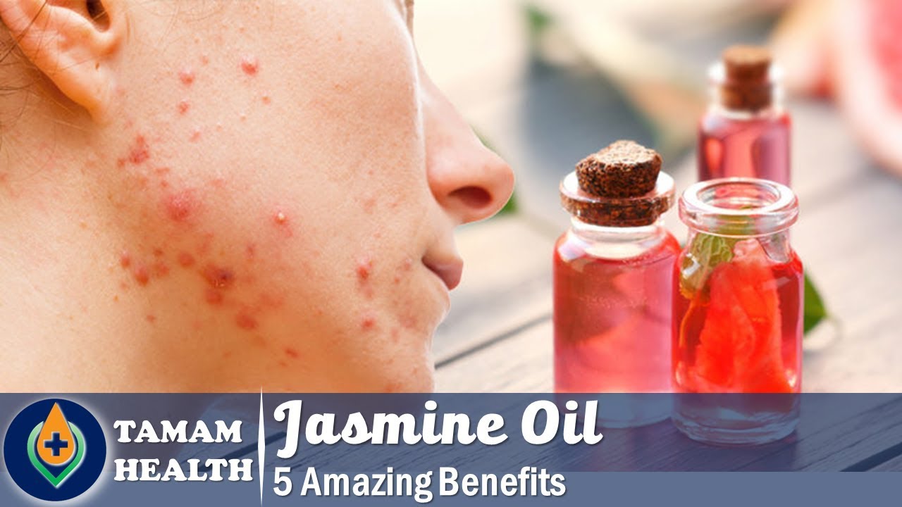 5 Amazing Benefits Of Jasmine Oil Anita Fincham Aromatherapy Massage