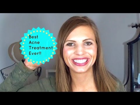 BEST NATURAL ACNE TREATMENT EVER!!