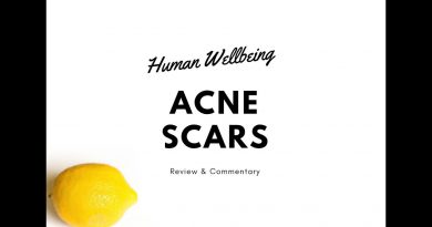 GET RID OF ACNE SCARS using lemon essential oils!