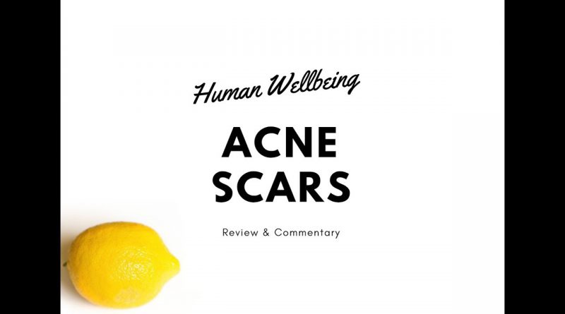 GET RID OF ACNE SCARS using lemon essential oils!