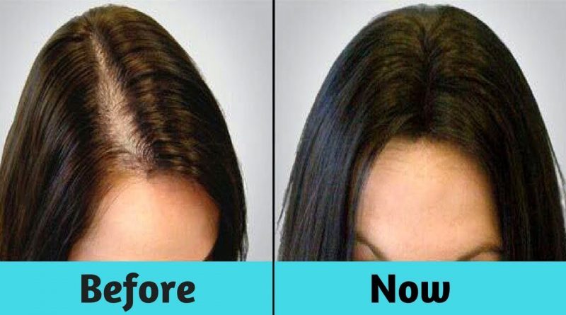 How To Use Peppermint Oil To Stop Hair Loss