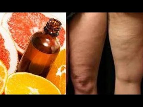 Melt Your Stubborn Cellulite with Grapefruit Essential Oil