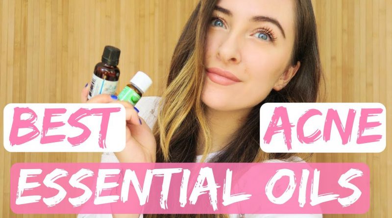 My Favourite ESSENTIAL OILS for ACNECLEAR SKIN