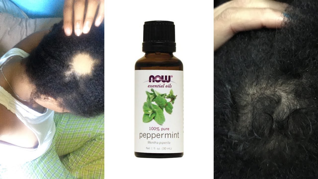 peppermint oil for hair growth before and after