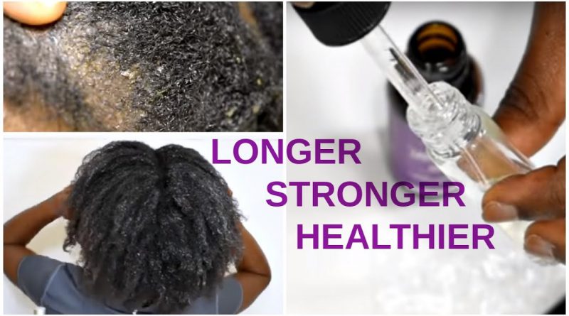 10 Lavender Oil Benefits for Natural Hair GROWTH & SCALP REPAIR | Naturenics