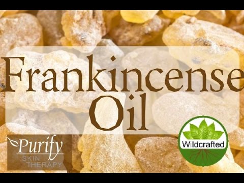Frankincense Essential Oil ~ All You Need To Know!